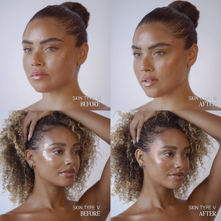 A four-panel before-and-after comparison showing two models with different skin types (III and V) with and without a skincare product applied, labeled 'SKIN TYPE III BEFORE/_AFTER' and 'SKIN TYPE V BEFORE/_AFTER'.
